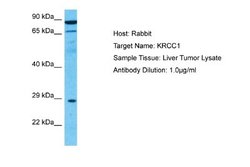 Lysine-rich coiled-coil 1 Antibody, Novus Biologicals 100 &mu;L; Unconjugated:Antibodies,